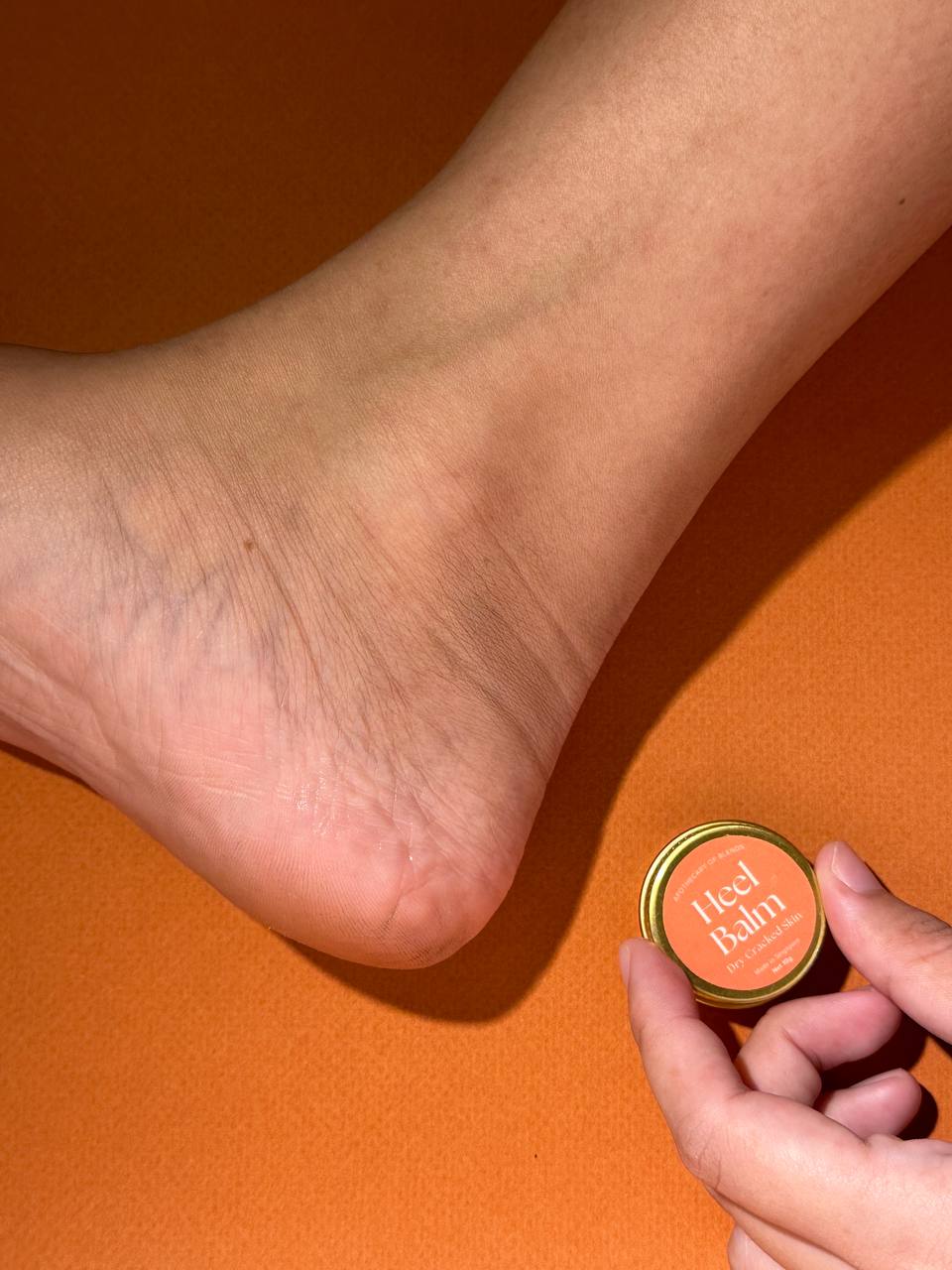 Best Seller - EASE Dry Cracked Heel Balm